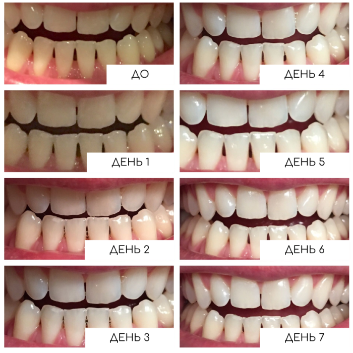 Отбеливающие полоски Medica+ 3DWhite Strips