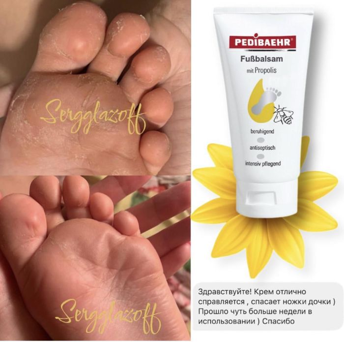 Бальзам з Прополісом FUSSBALSAM MIT PROPOLIS, PediBaehr - 30 мл