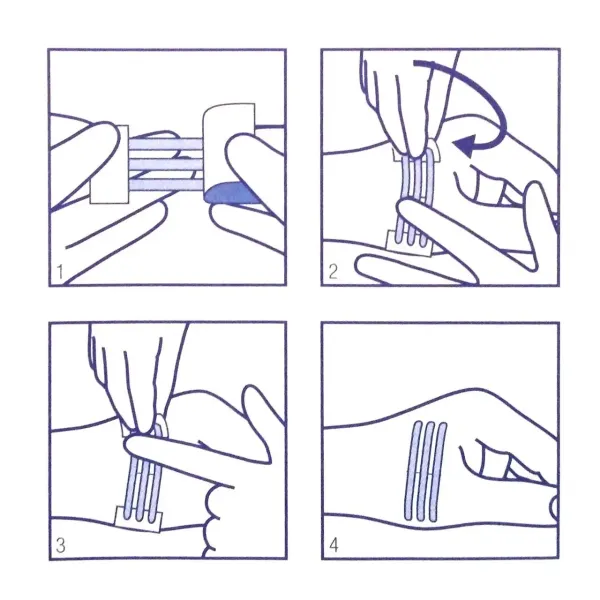 Смужки для безшовного закриття ран Omnistrip® / Омністріп 3мм x 76мм, 5 смужок (1х5шт)