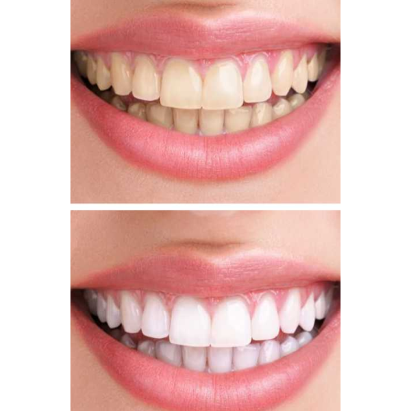 Звукова зубна щітка Medica+ ProBrush 7.0 Compact Black